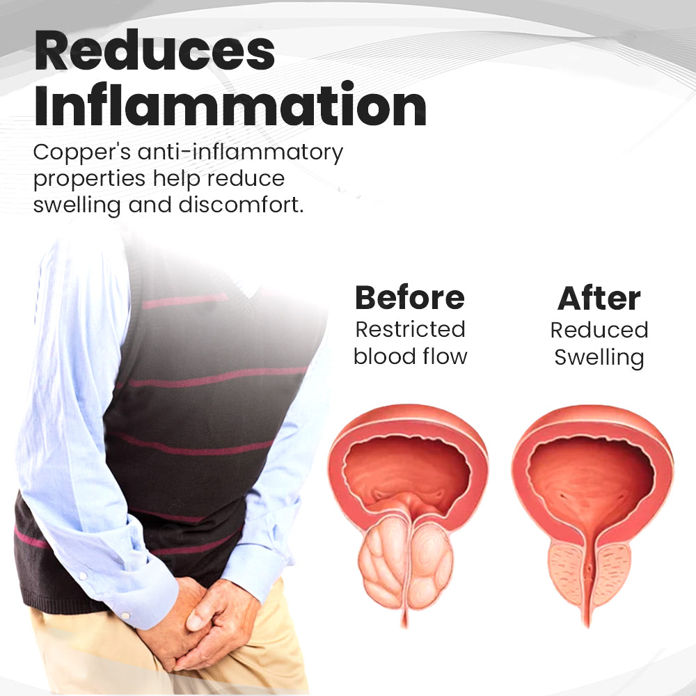 Up to 72% off 🎇 Histone™ Copper Mag Prostate Therapy Ring